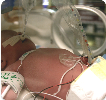 Neonatal Resuscitation Setup