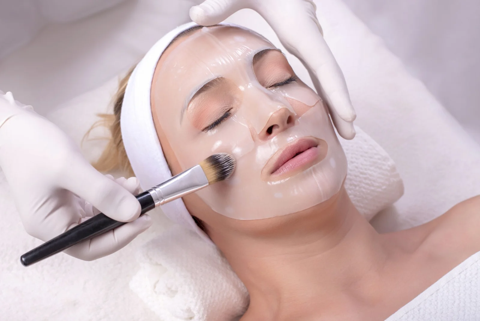 Chemical Peels (Pigmentation, Acne Scarring) Banner