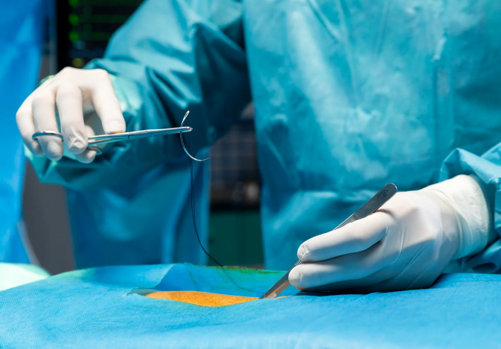 Surgical Resection (GI Cancers, Complicated IBD, Diverticulitis) Banner