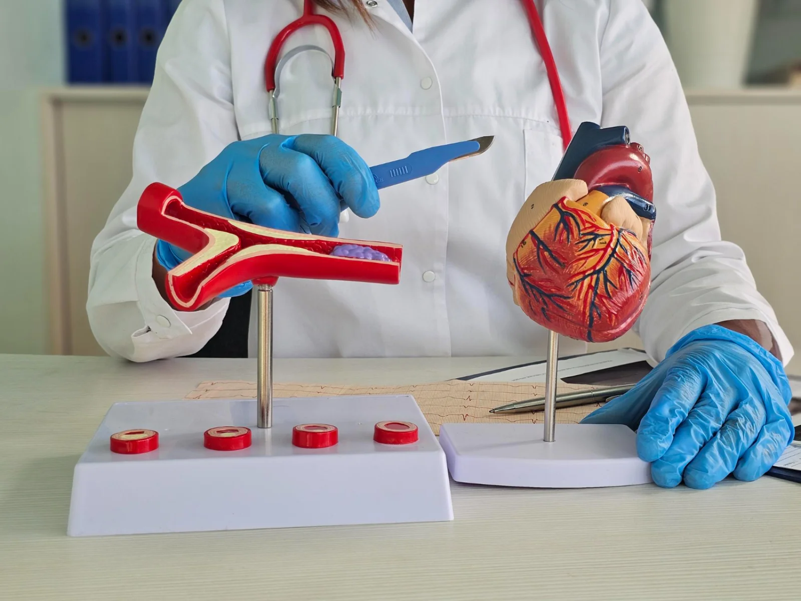 Endovascular Angioplasty / Stenting (Peripheral, Carotid, Renal) Banner