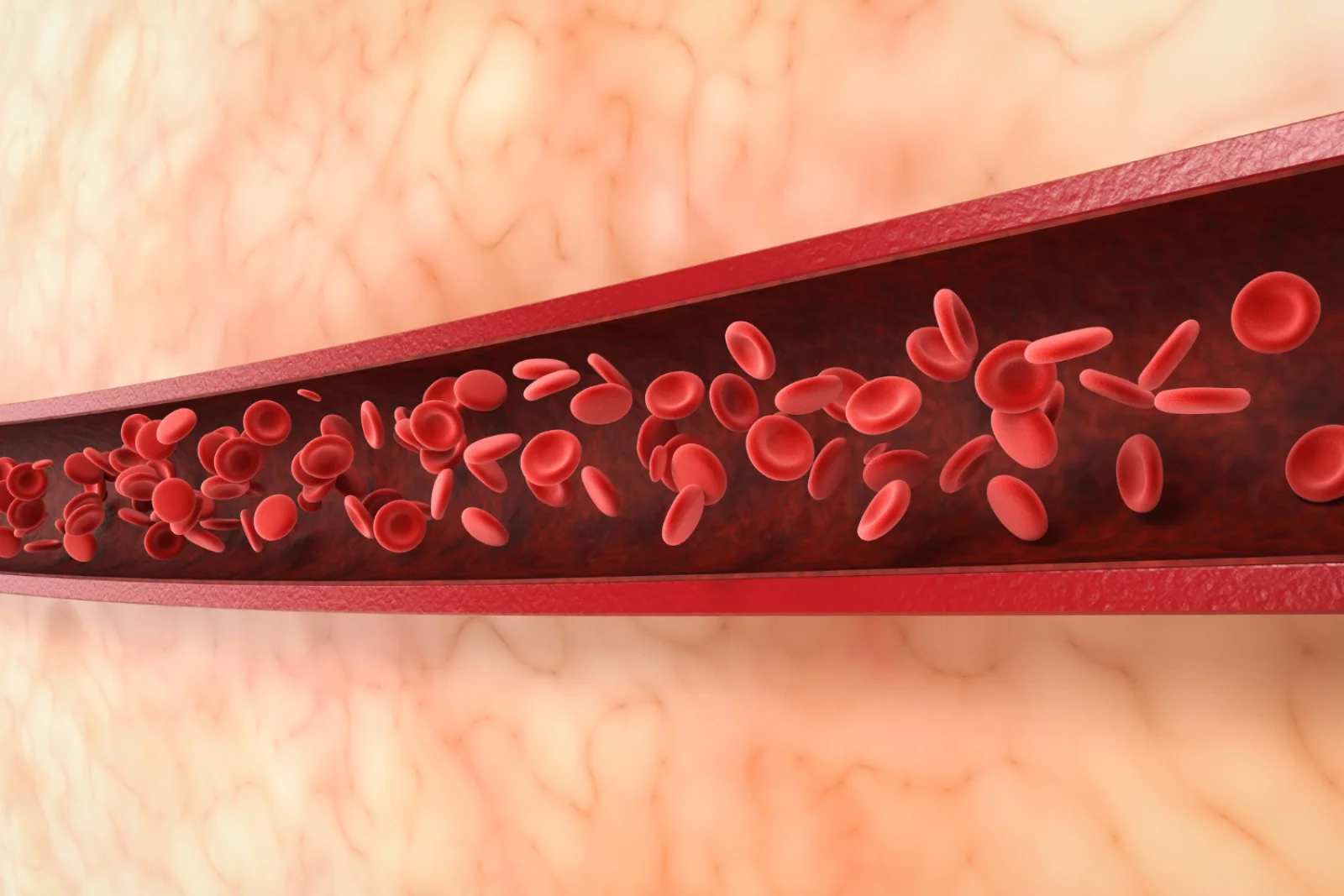 Thrombolysis / PCI for STEMI Banner
