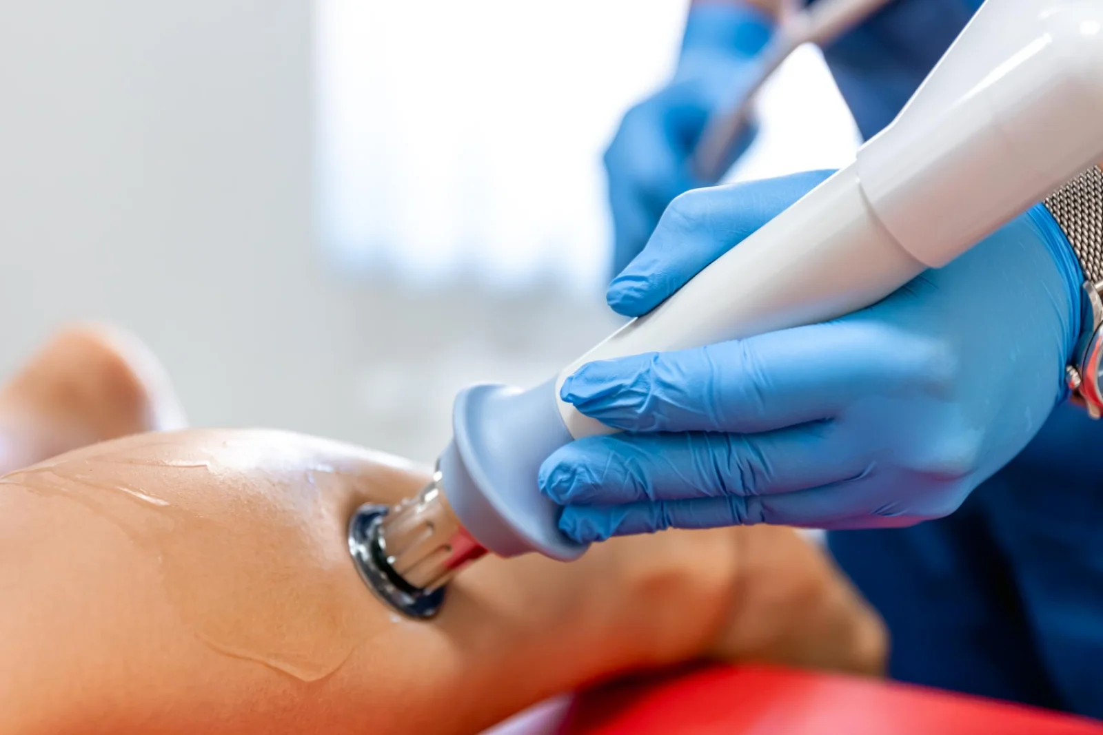 Scar Management Laser Devices Banner