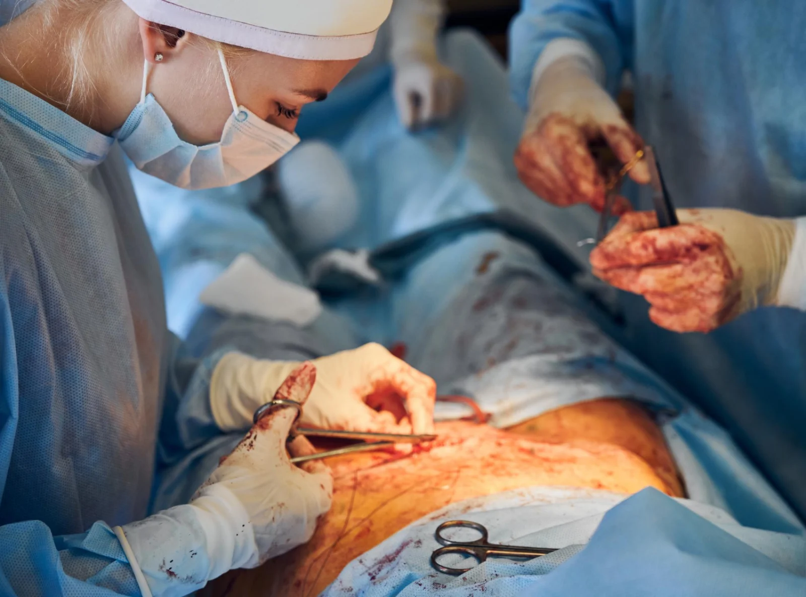 Exploratory Laparotomy Banner