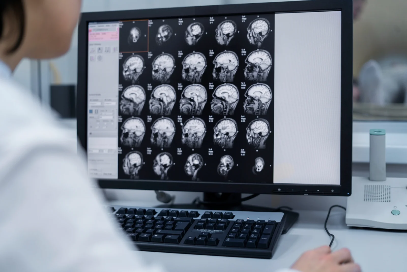 CT Brain Banner