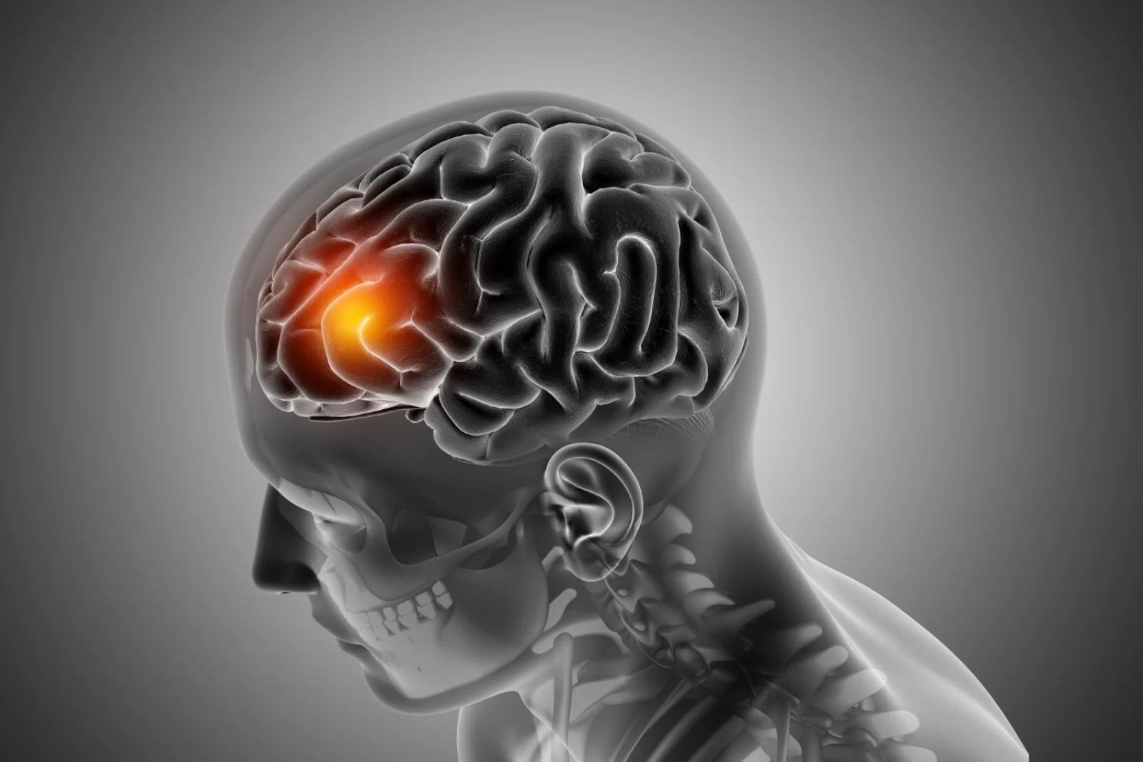 Brain Tumors (Primary/Secondary) Banner