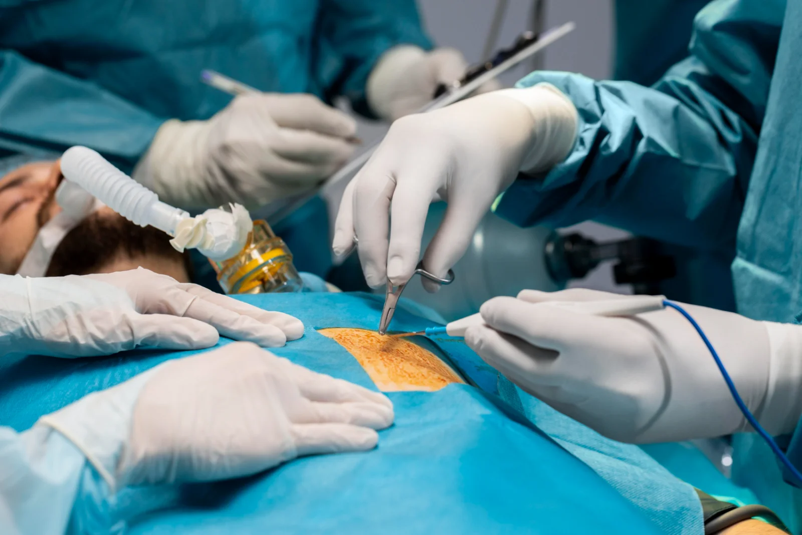 Fasciotomy (Compartment Syndrome) Banner