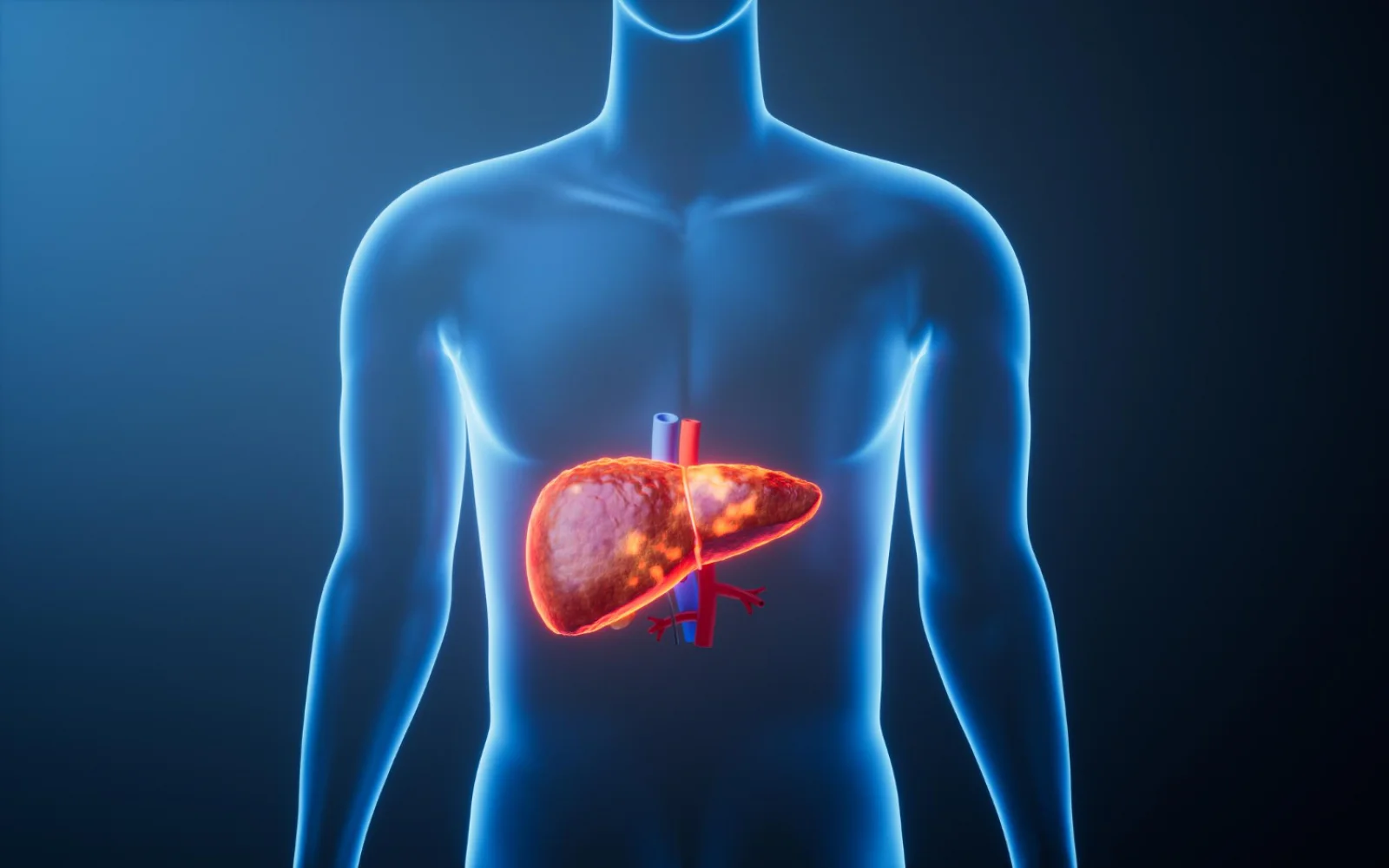 TIPS (Transjugular Intrahepatic Portosystemic Shunt) Banner