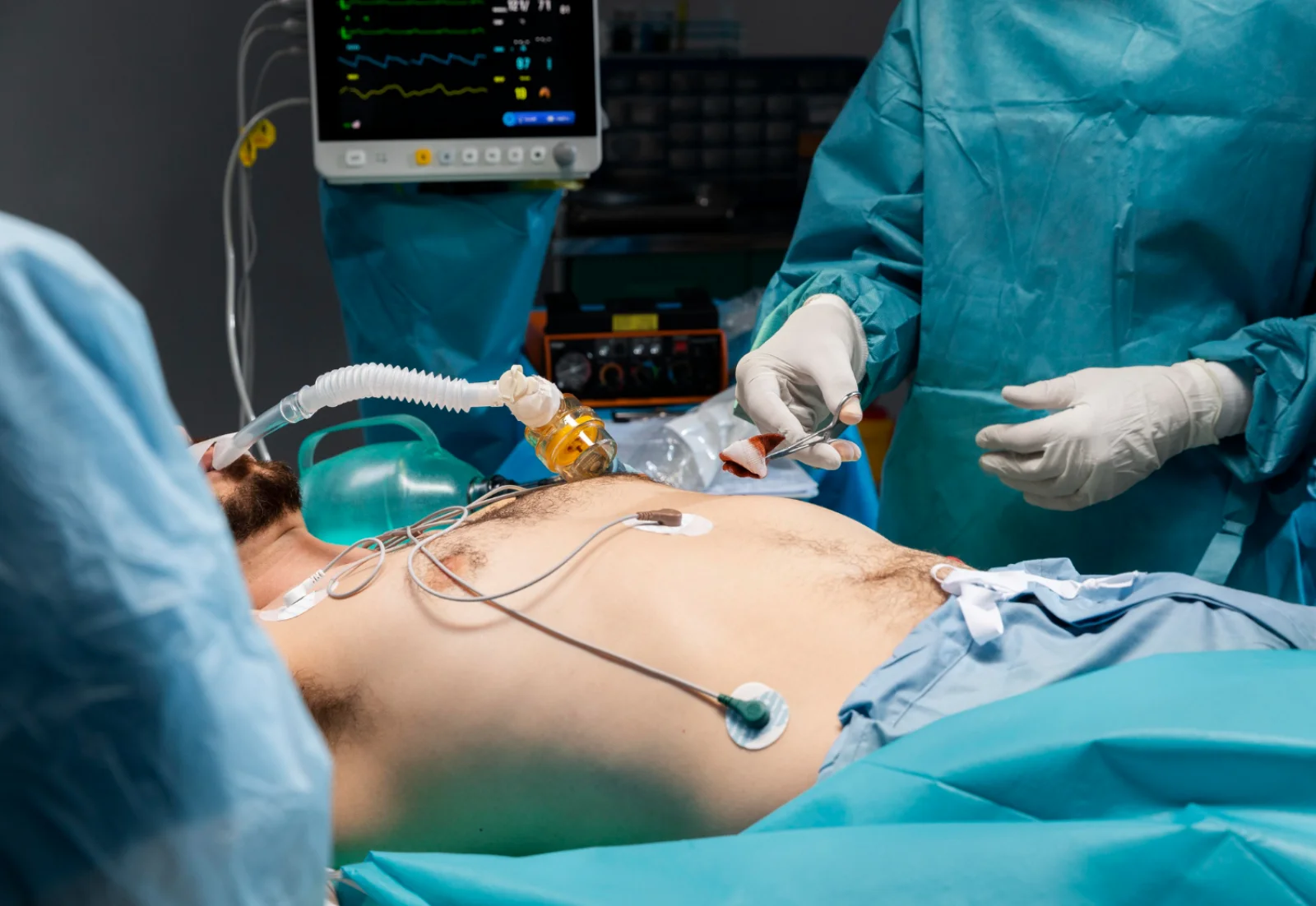 Mesenteric Revascularization (Endovascular / Open) Banner