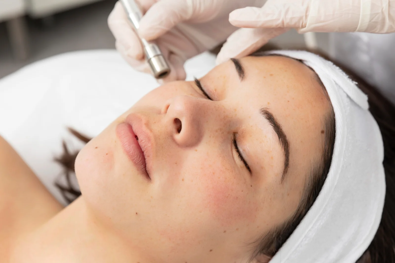 Dermabrasion / Microdermabrasion Banner