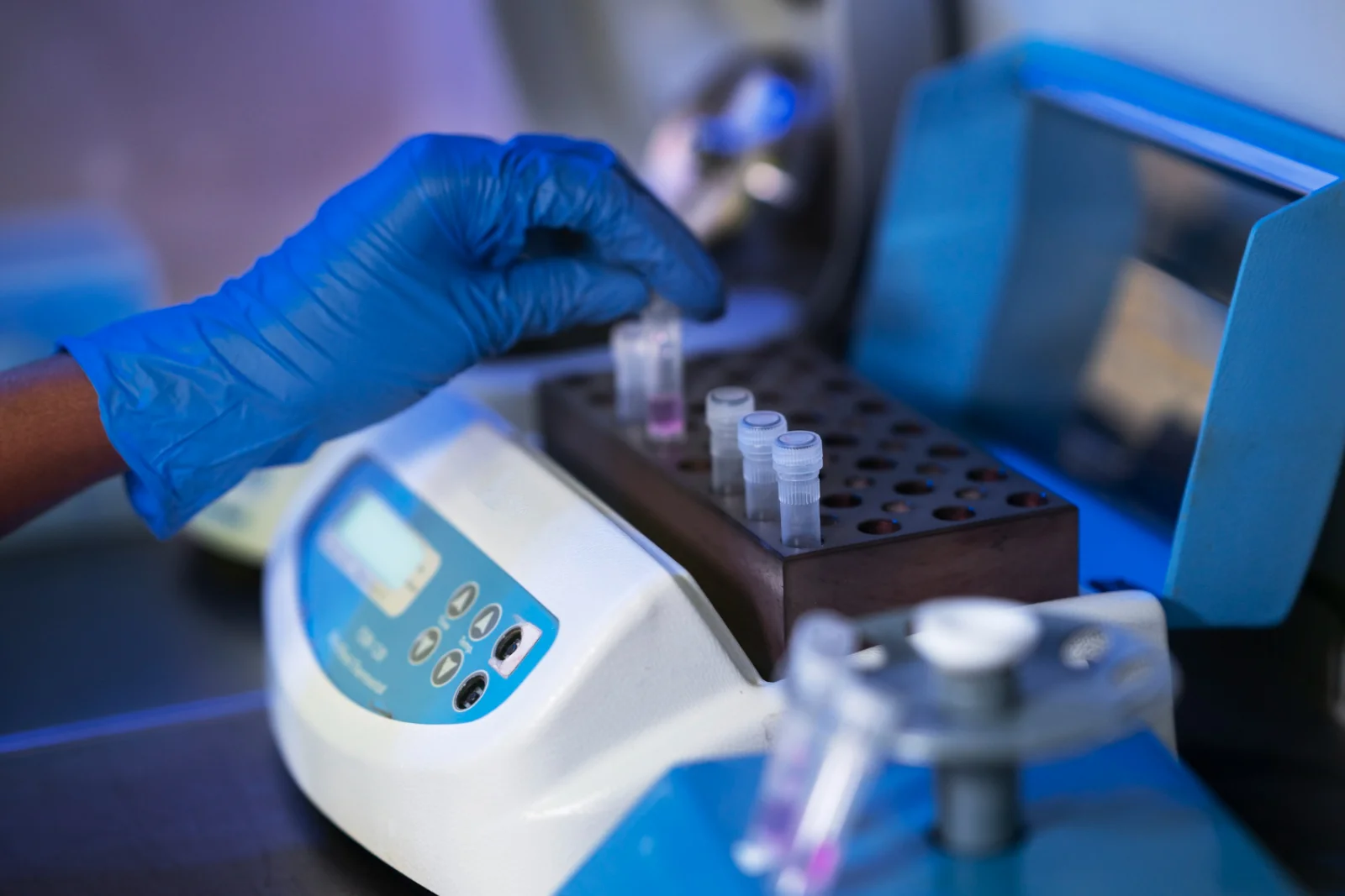 Automated Biochemistry Analyzer Banner