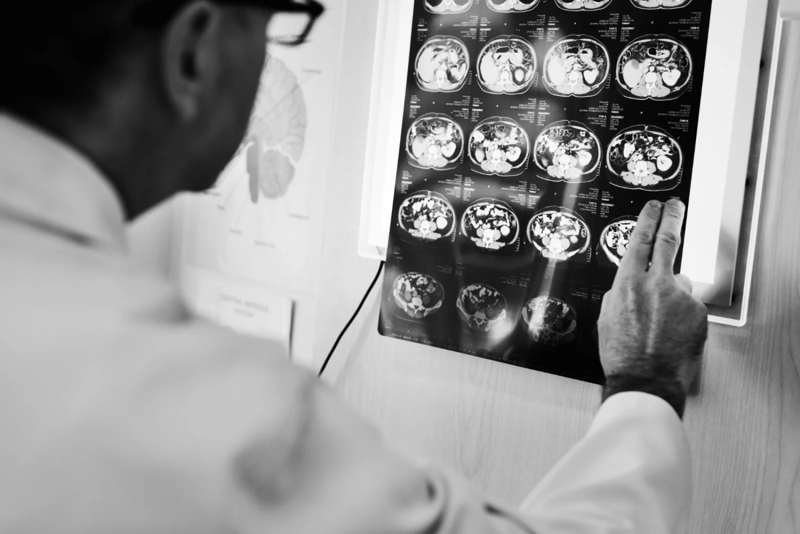 Computed Tomography — CT Brain Banner