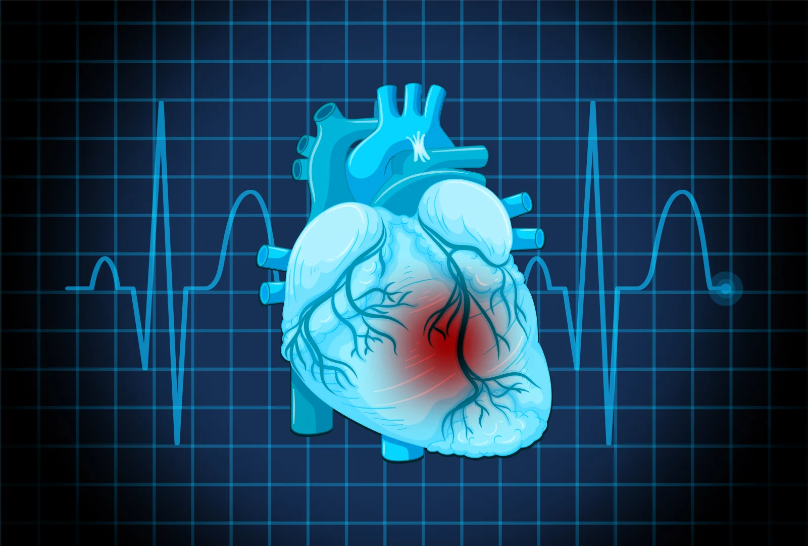 Cardiac CT / Coronary Angiography Banner