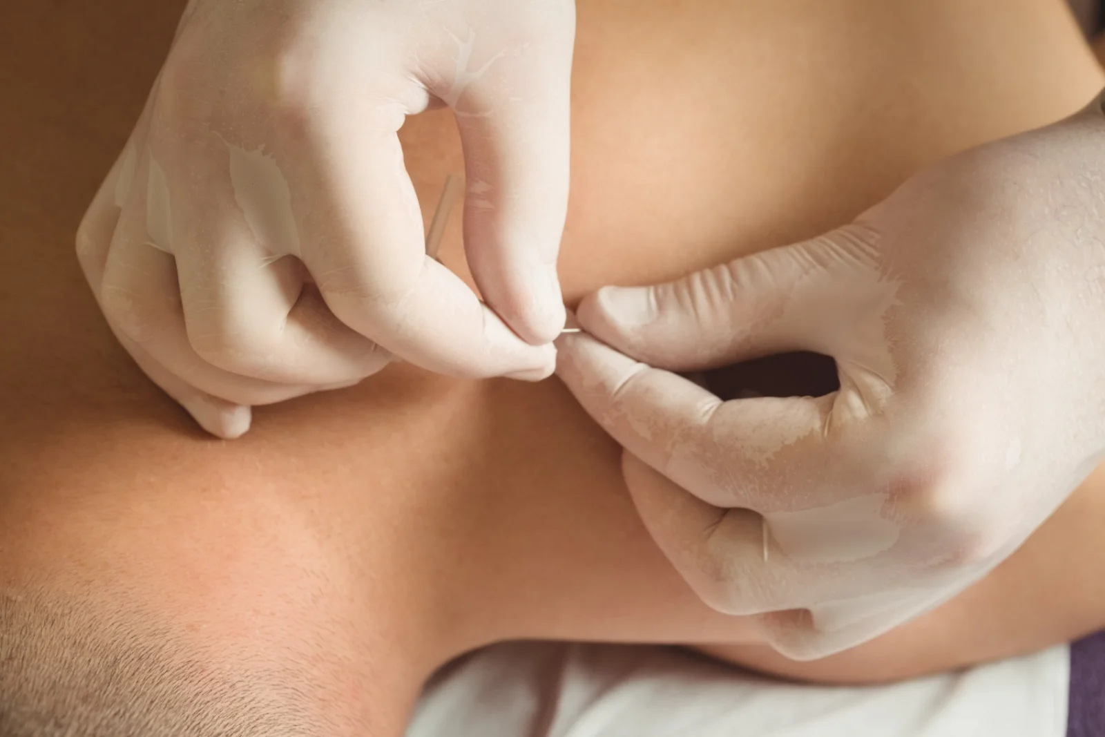 Abscess Incision & Drainage Banner