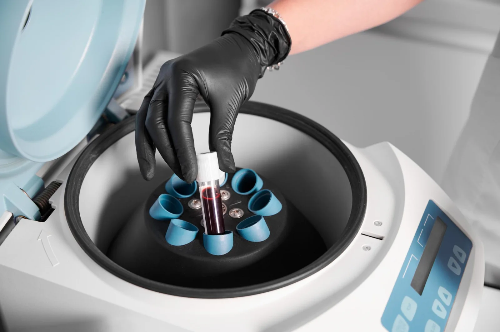 Renal Function Test Analyzer Banner
