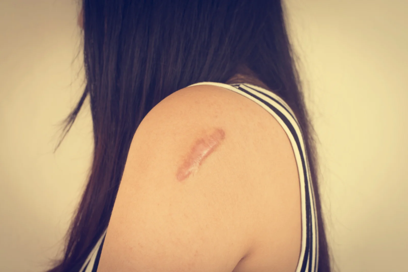 Scar Management & Cosmetic Dermatology Procedures Banner