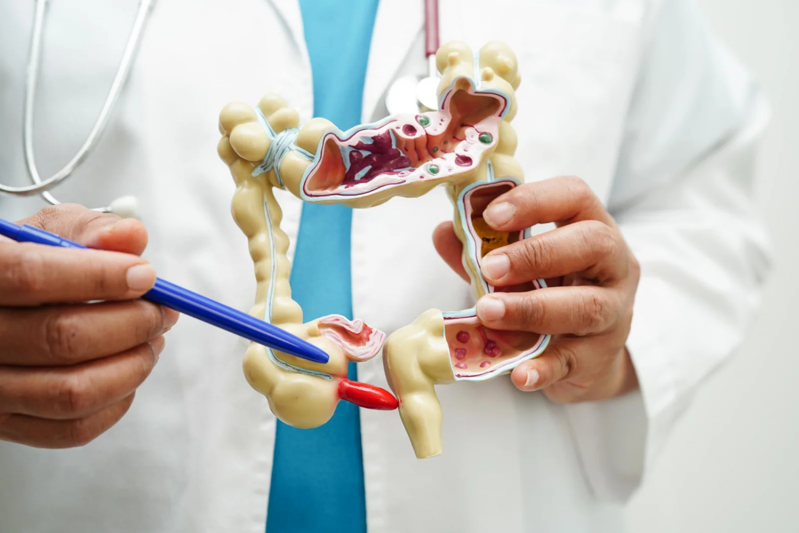 Appendectomy (Open / Laparoscopic) Banner