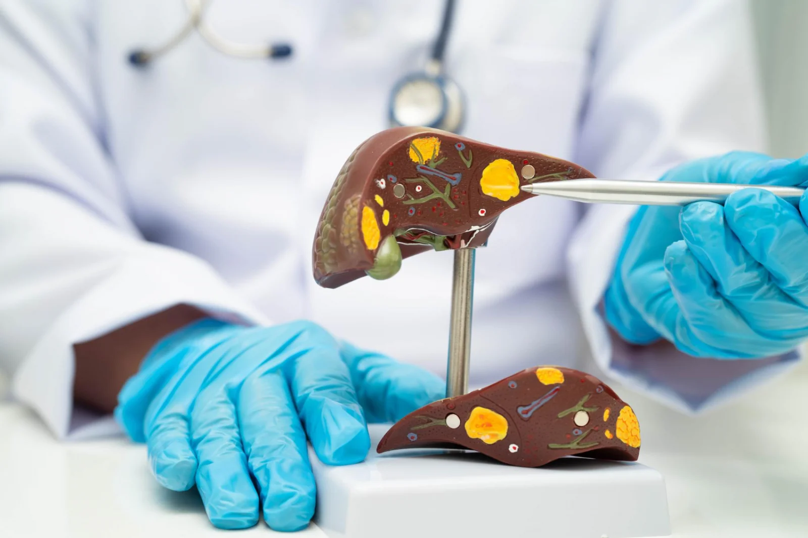 Liver Biopsy (Percutaneous / Transjugular) Banner