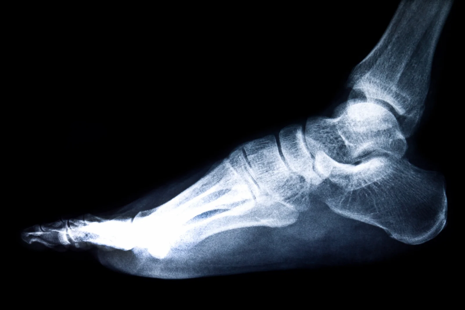 Imaging for Foot (X-ray, MRI) Banner
