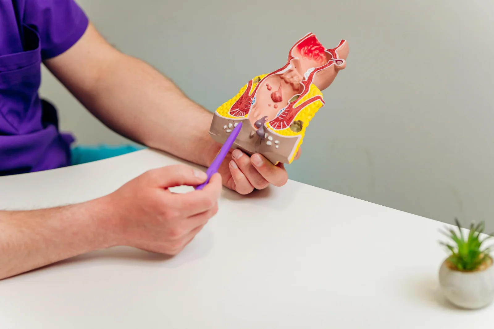 Radical Cystectomy with Urinary Diversion Banner