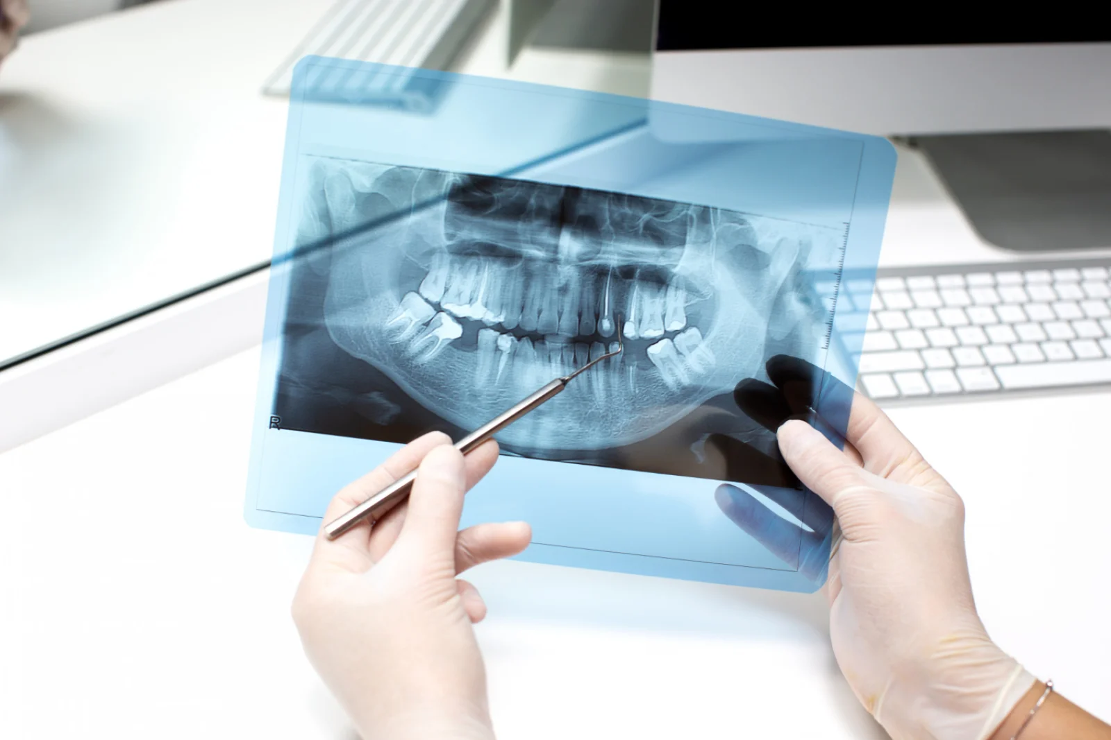 Intraoral & Panoramic X-ray / CBCT Banner
