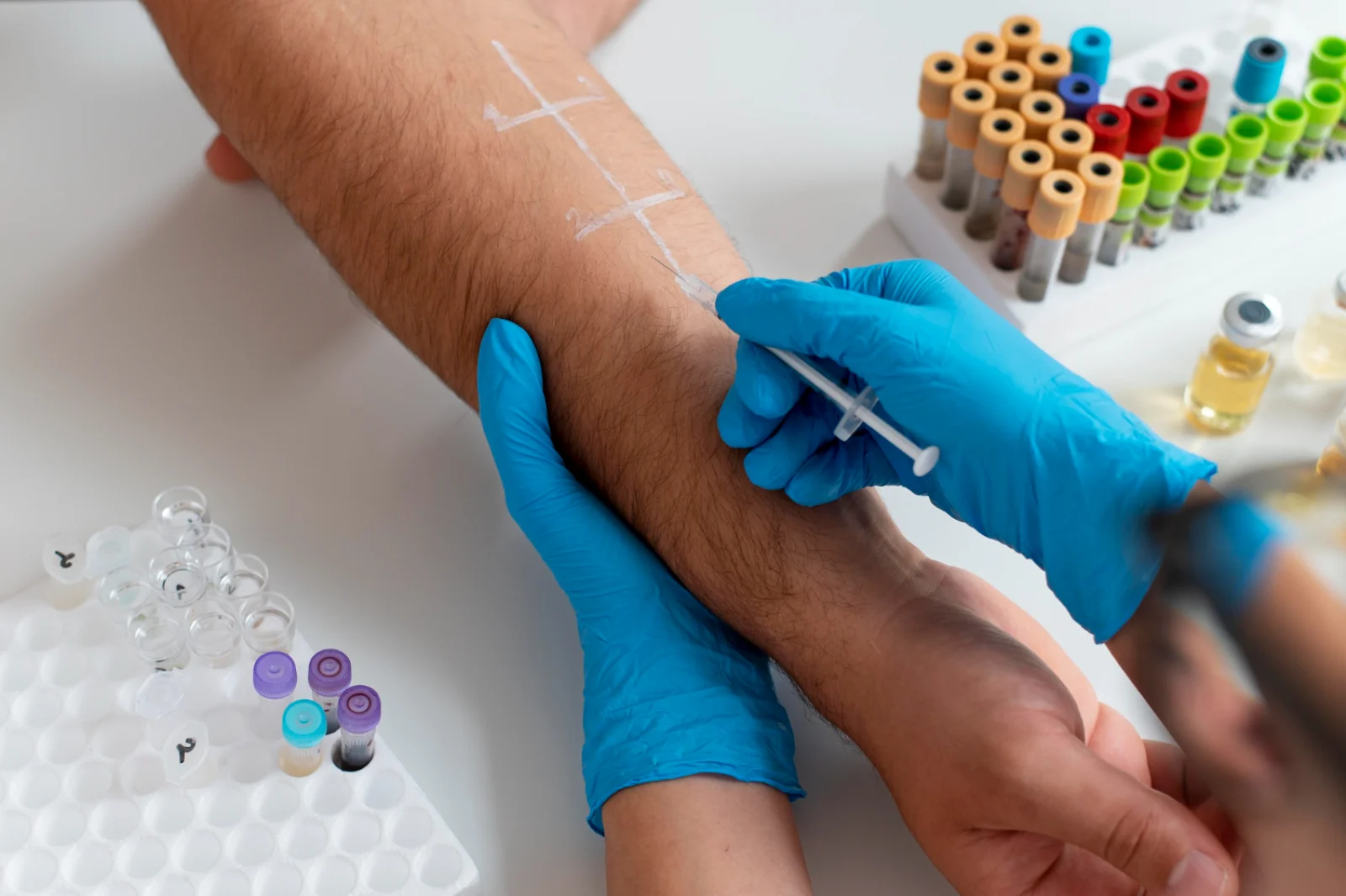 Management of Vascular Graft Infections (Debridement, Revascularization) Banner