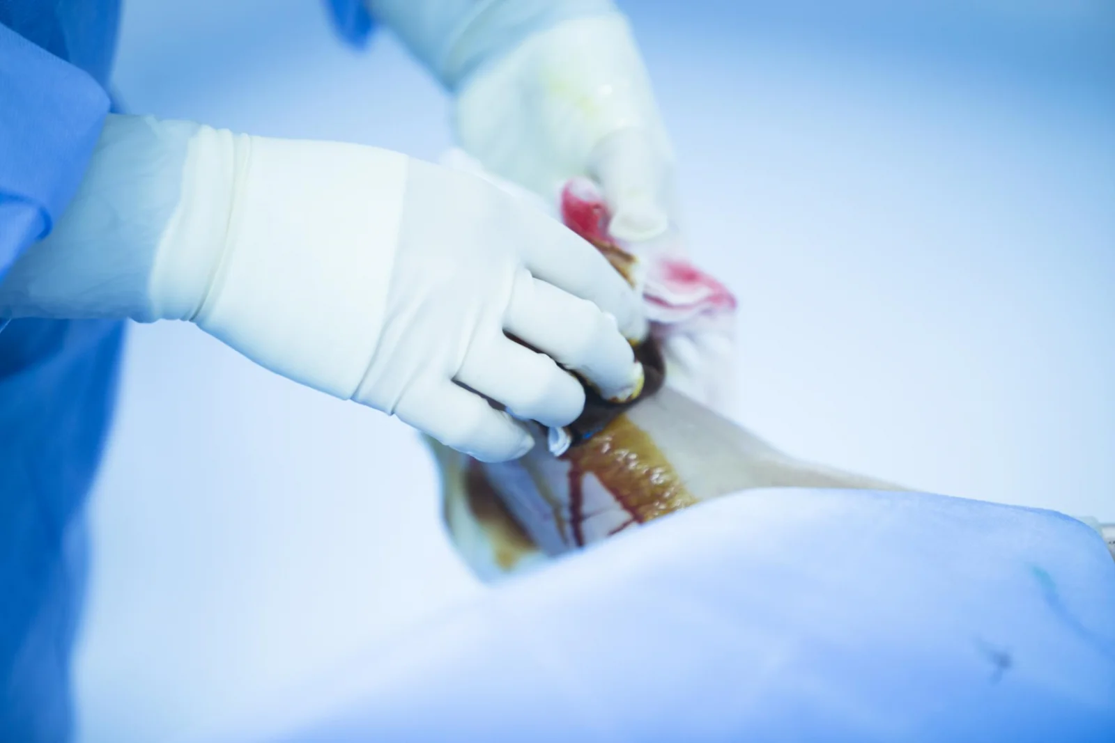 Postoperative Rehabilitation, Wound Care & Surveillance Banner