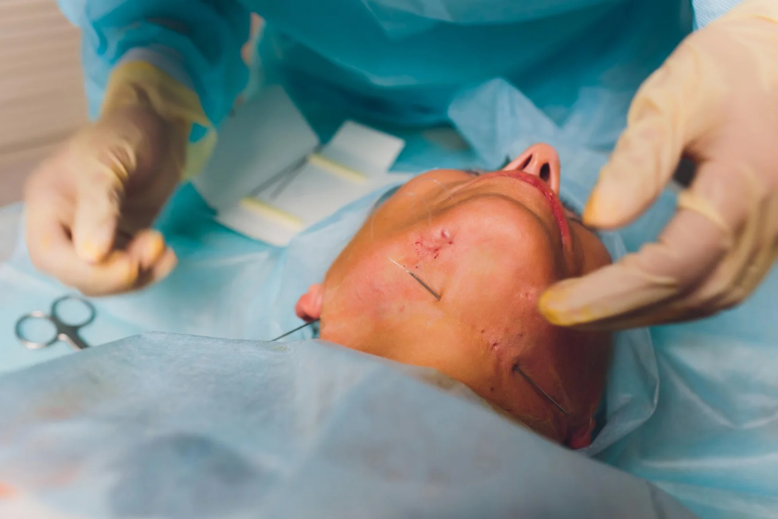 Evacuation of Intracranial Hematoma Banner