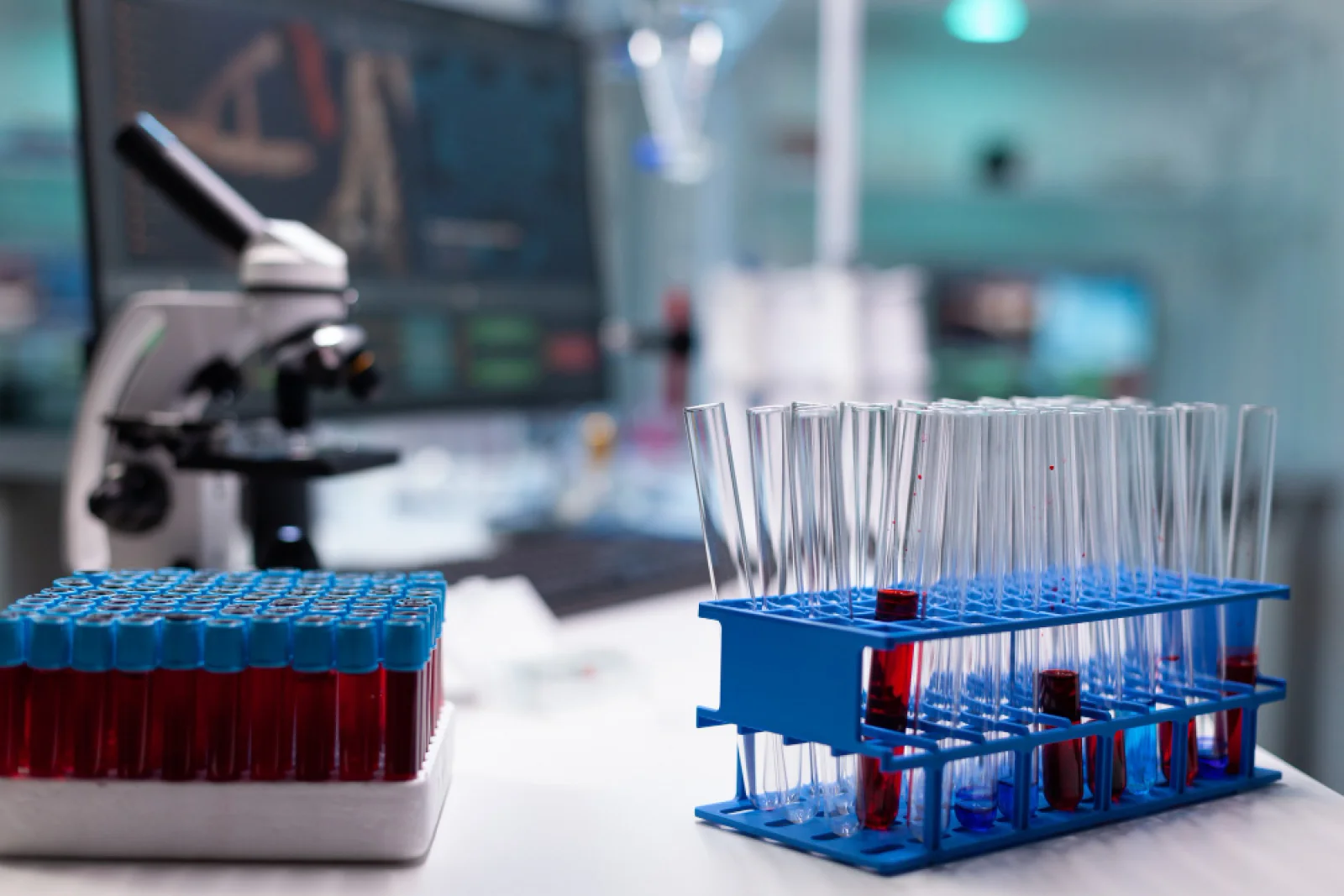 Best Diagnostics & Laboratory Medicine hospital in Bangalore